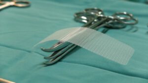How to File a Hernia Mesh Lawsuit in North Carolina