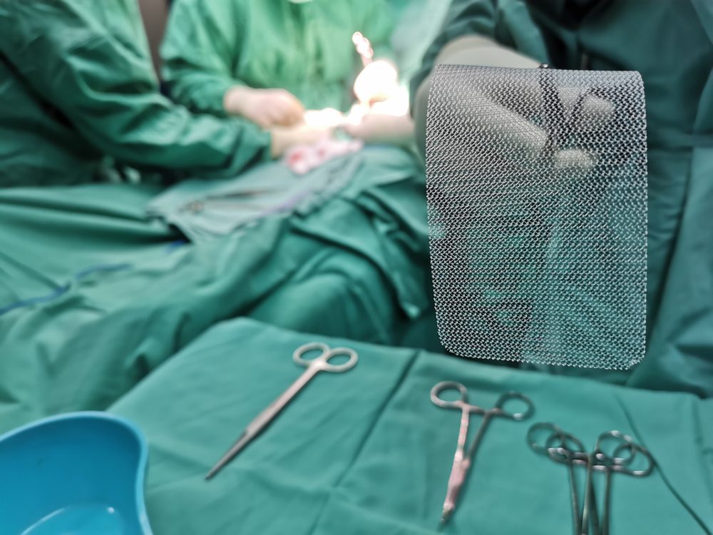 ¿Cuál es el estado de la litigación sobre la malla para hernias?